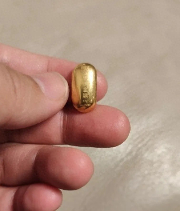 11岁孩子误吞10克重的金豆！妈妈称“天天叮嘱他不要在外面上厕所”